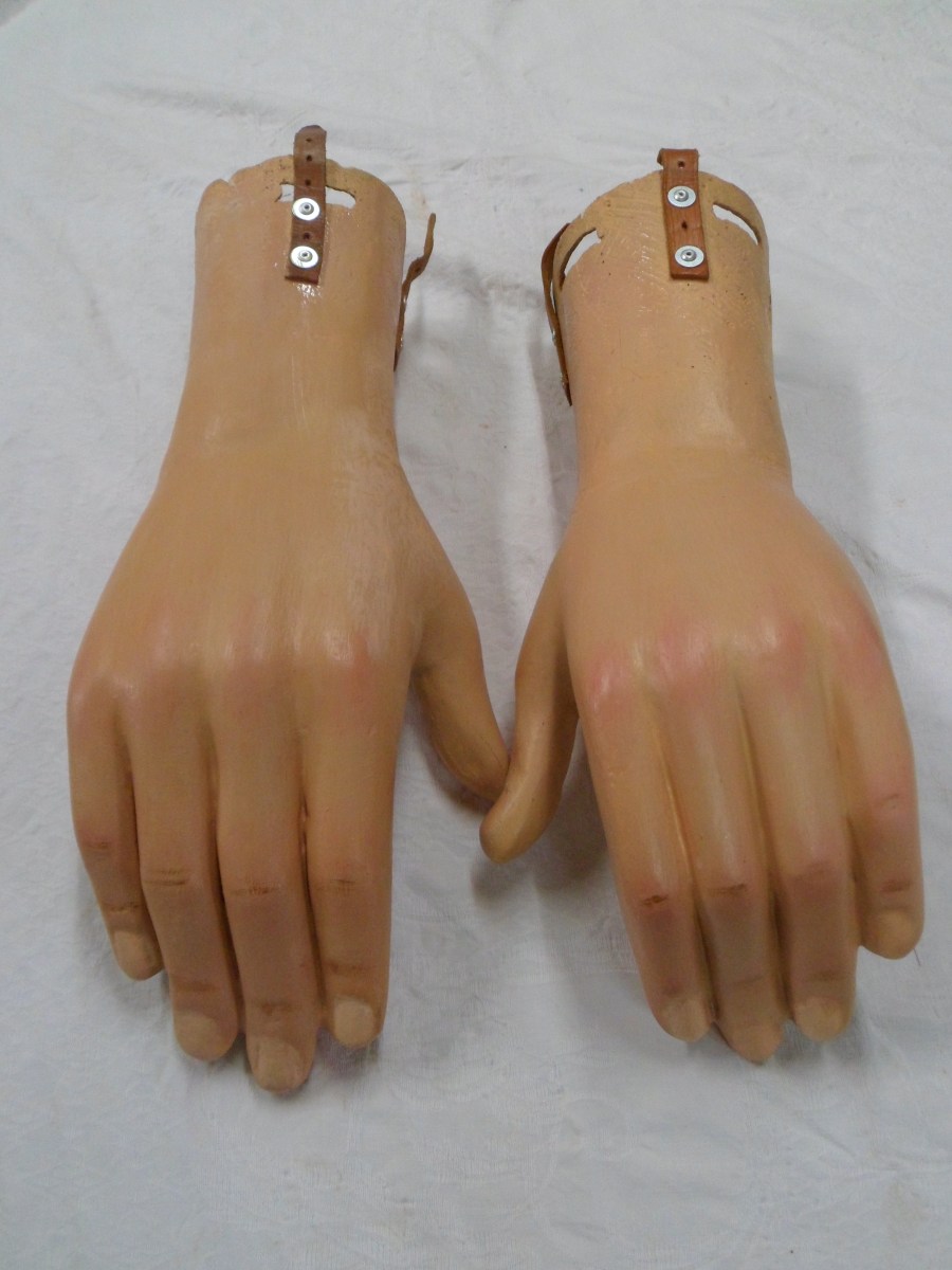 restauracion-manos-burlada-antes