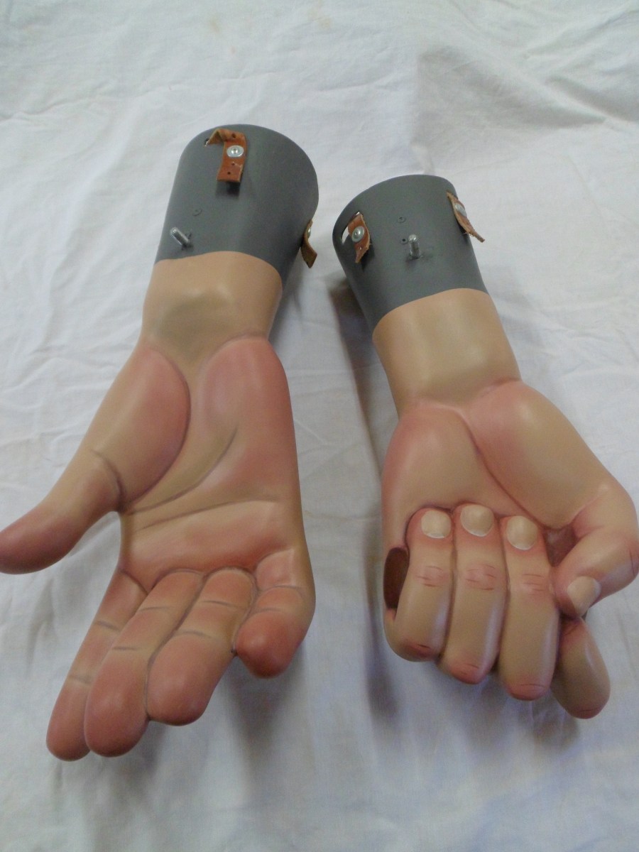 restauracion-manos-burlada-despues-3