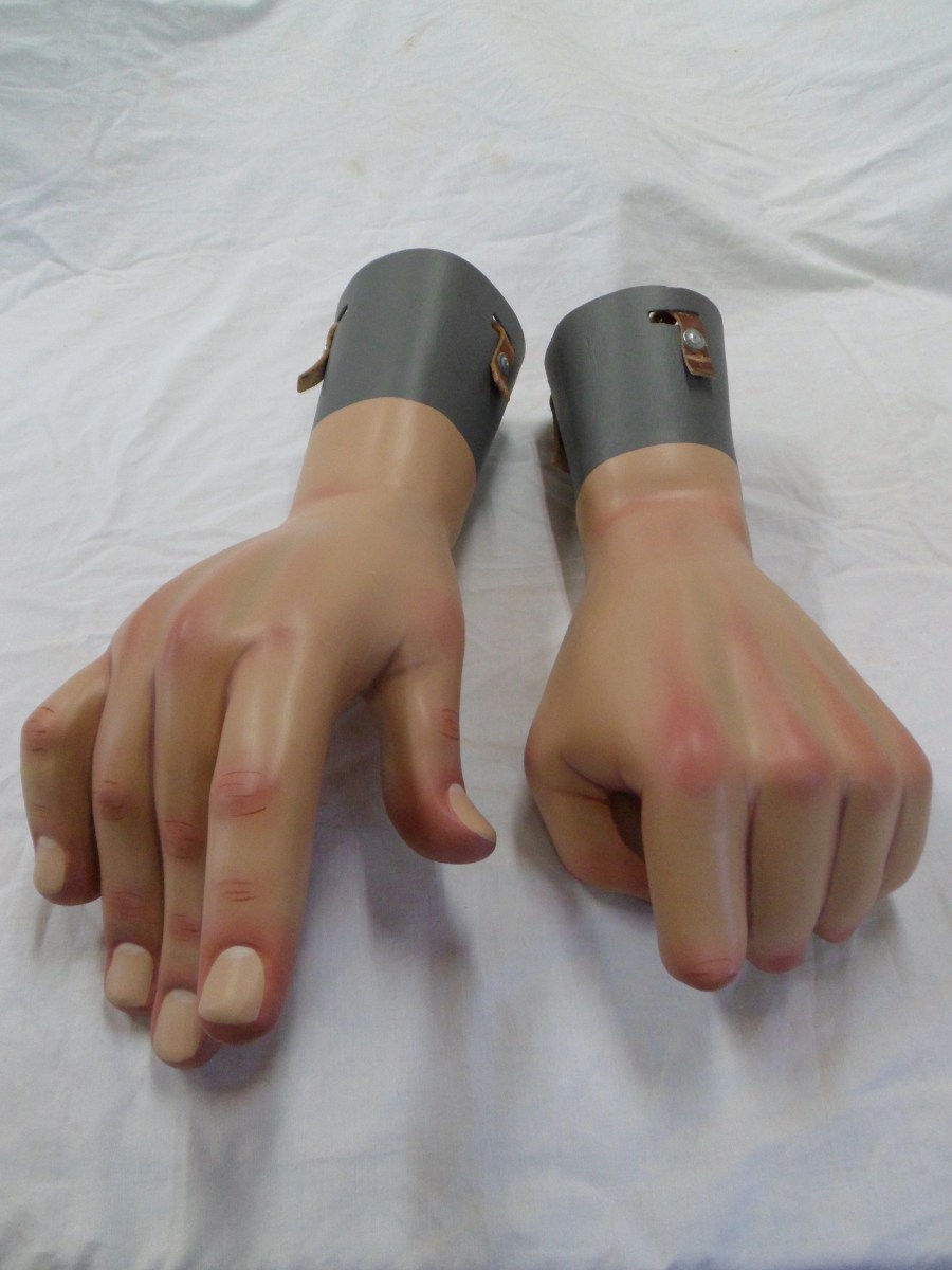 restauracion-manos-burlada-despues-2