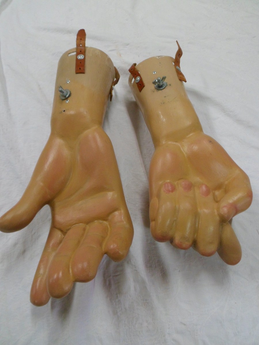 restauracion-manos-burlada-antes-1