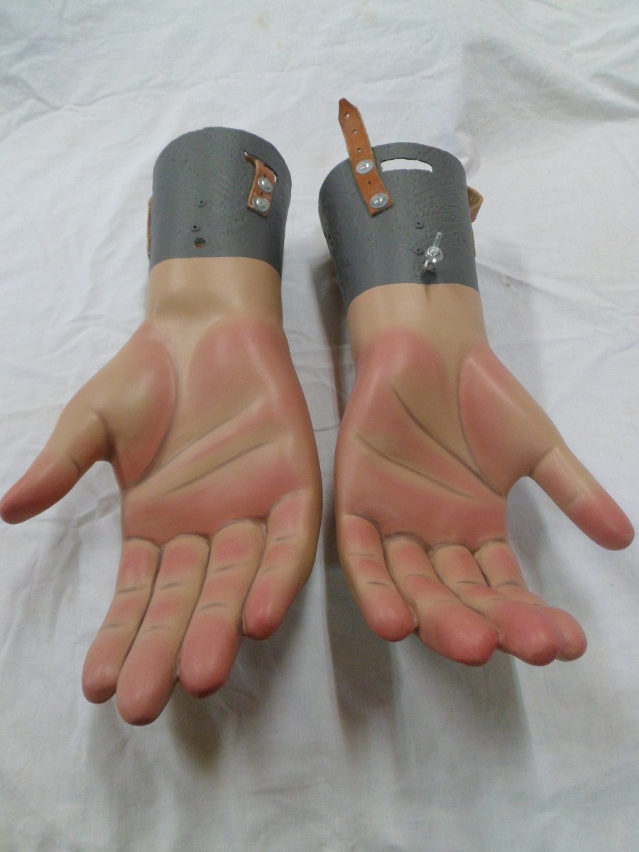 restauracion-manos-burlada-despues-1