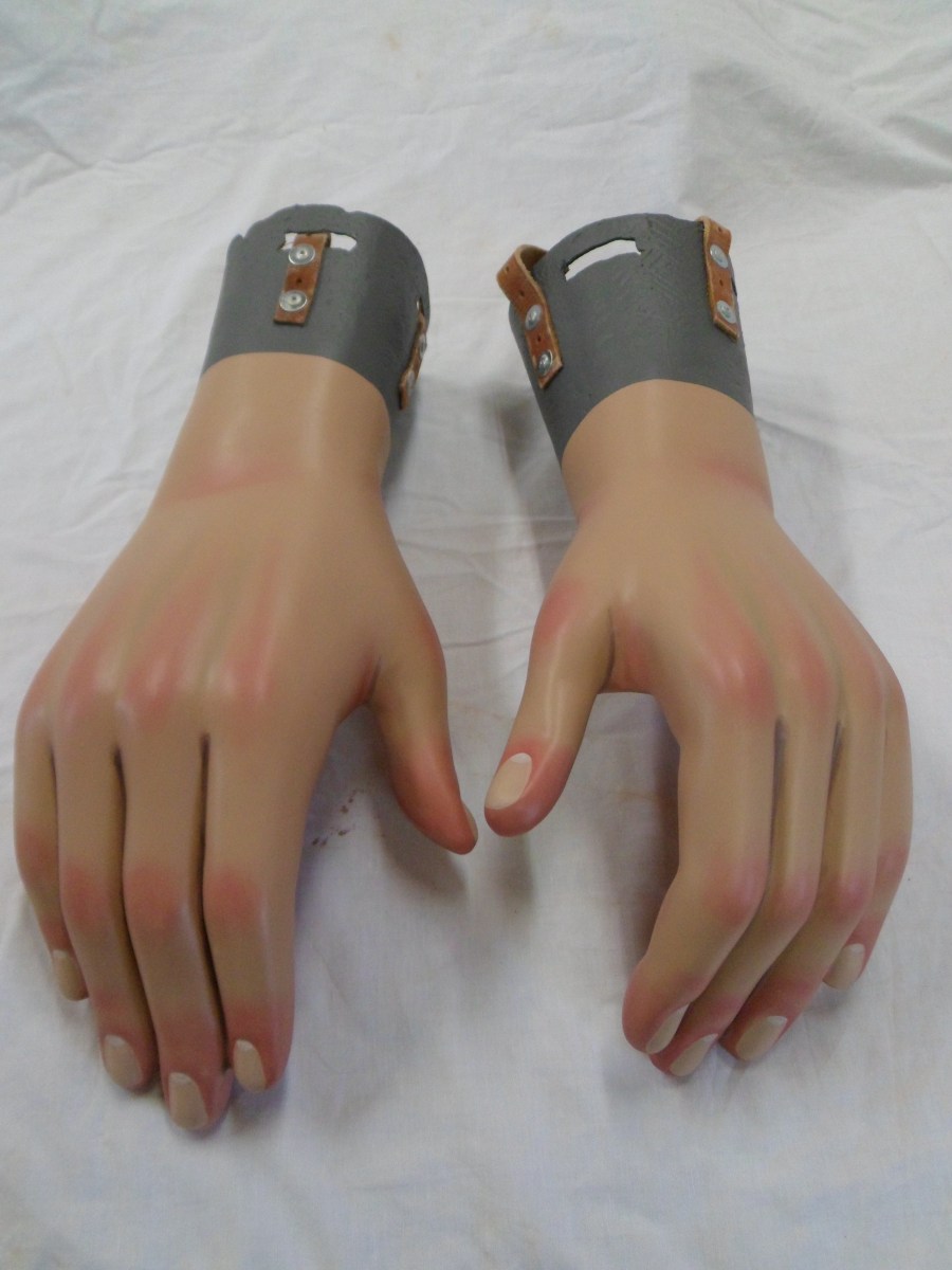 restauracion-manos-burlada-despues